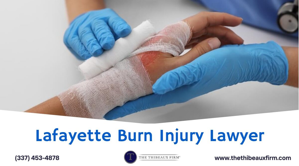Lafayette Burn Injury Lawyer